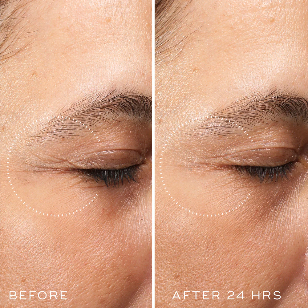 20230203_-_Crystal_Retinal_Ceramide_Eye_-_Extended_Product_Page_Assets_-_Before_and_After_24_hrs_-_1000_x_1000_-_For_Web